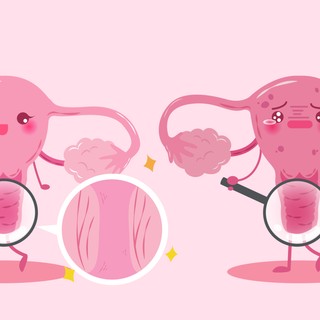 Petefészek elégtelenség: tünetei, vizsgálata és kezelési lehetőségei című cikk nyitóképe