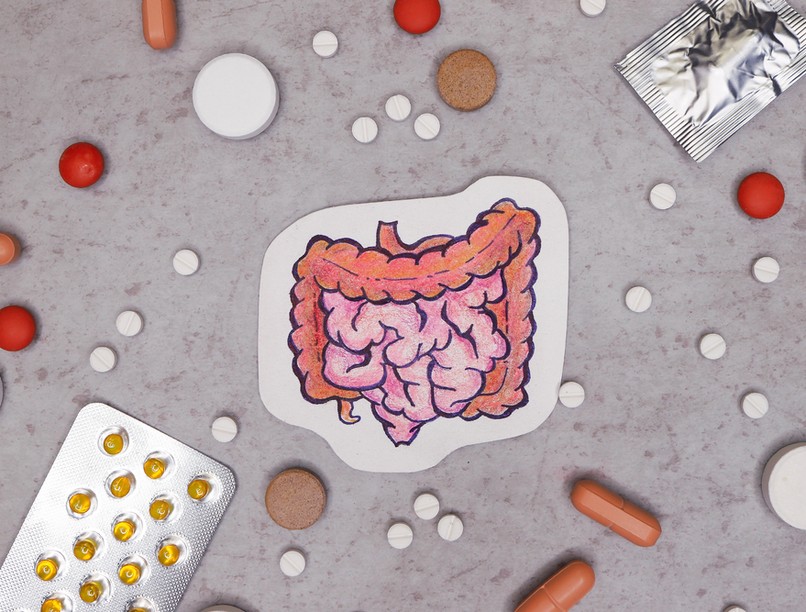 vastagbélrák, antibiotikum, bélflóra, daganat