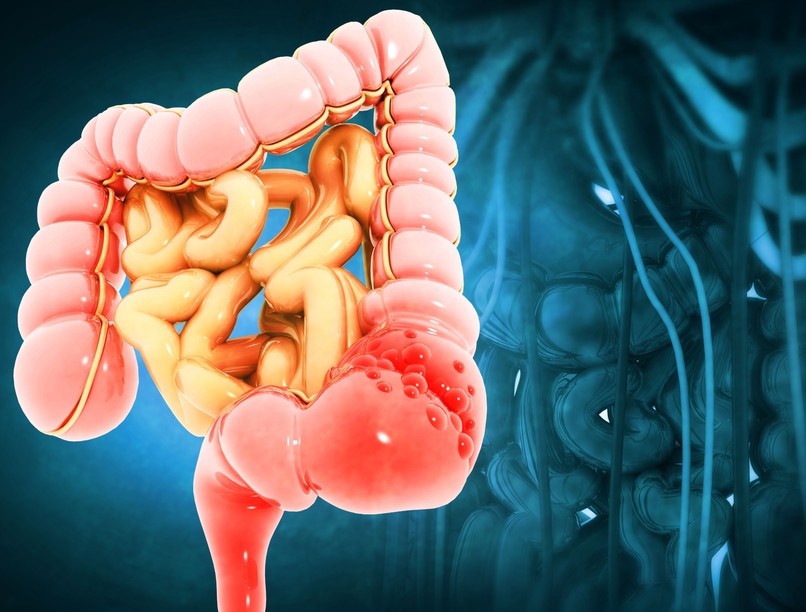 Vastagbélrák onkológia citotoxikus citosztatikus kezelés kemoterápia