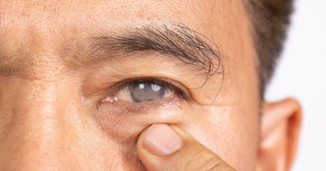 Szürkehályog műtét után: a gyógyulás hetei, amiről kevesen beszélnek