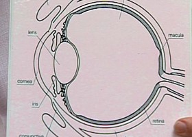A retinoblastoma az ideghártya rosszindulatú daganata, amely a gyermekkori szemészeti daganatok között a leggyakoribb betegség.