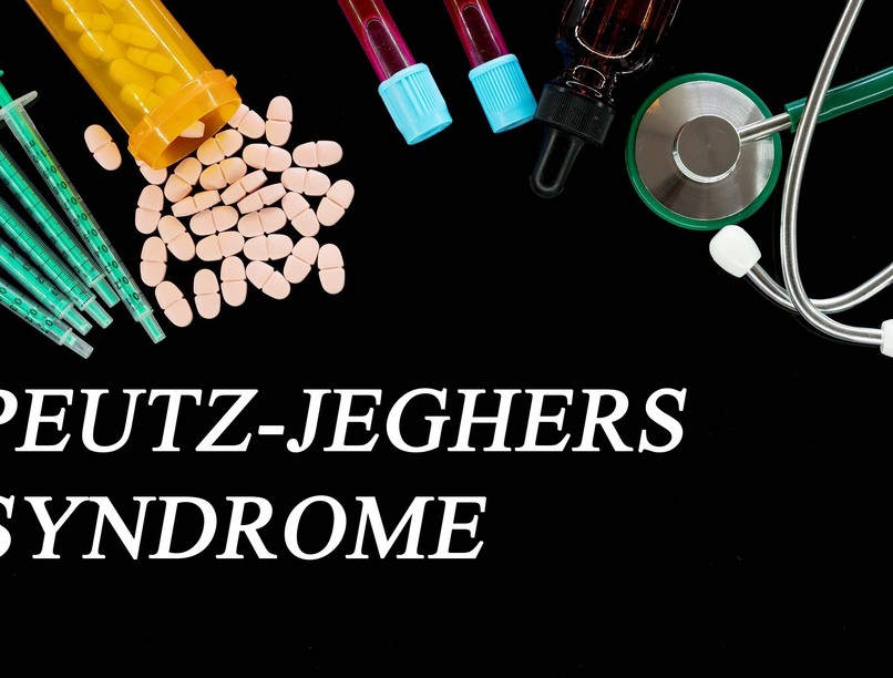 Peutz-Jeghers szindróma tünet vizsgálat kezelés