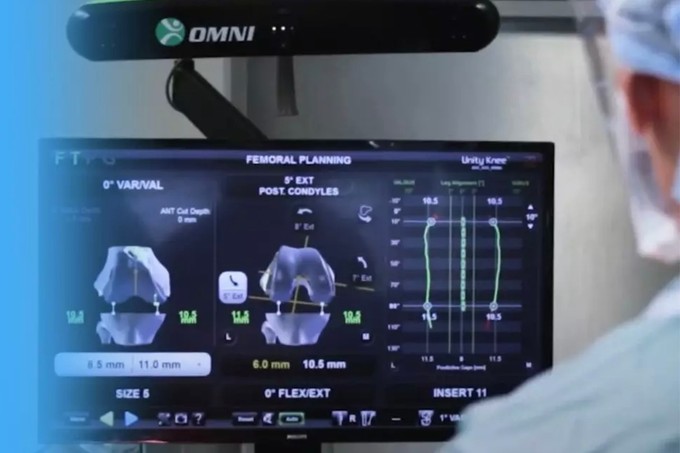 Ortopédia és rehabilitáció: így segíti elő a teljes felépülést című cikk nyitóképe