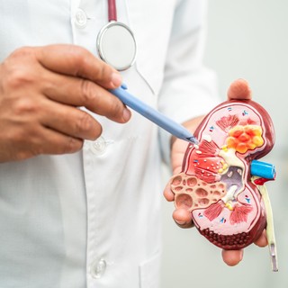 Beszűkült vesefunkció gyógyítása - ezt tegye, hogy elkerülhesse a dialízist című cikk nyitóképe