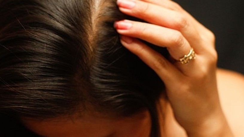 670px-choose-the-right-hair-loss-option-step-3