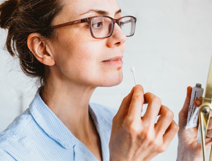 A fokozott stressz és fáradtság miatt könnyen alakulhat ki herpesz vagy afta / Fotó: Getty Images