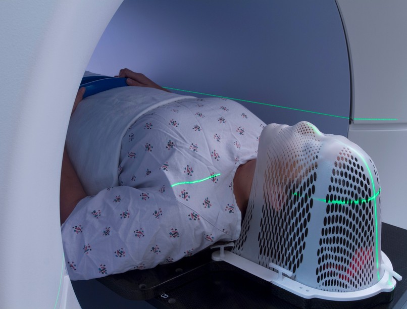 sugárterápia, új eszköz békés megye kórház