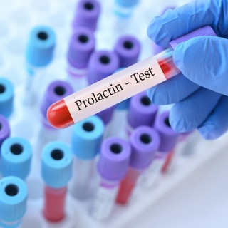 Prolaktin-hiány: tünetei, vizsgálata és kezelési lehetőségei című cikk nyitóképe