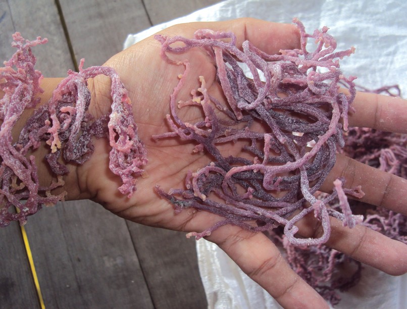 E407 károsítja az egészséget, bélperforáció cukorbetegség