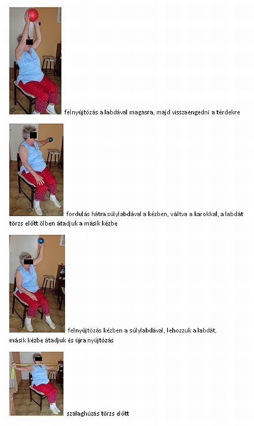 Parkinson-kór gyógytorna kezelése (3. rész)