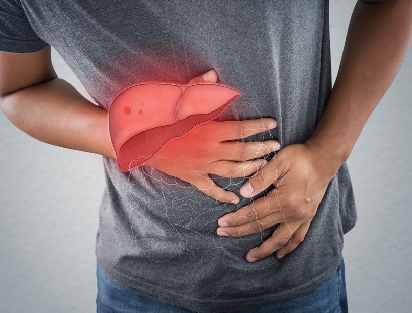 májbetegség, májcirrózis, májzsugor