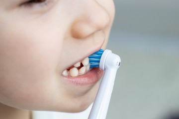 Kihagyta a fogmosást a gyerek? A megfázásra is nagyobb lehet az esélye