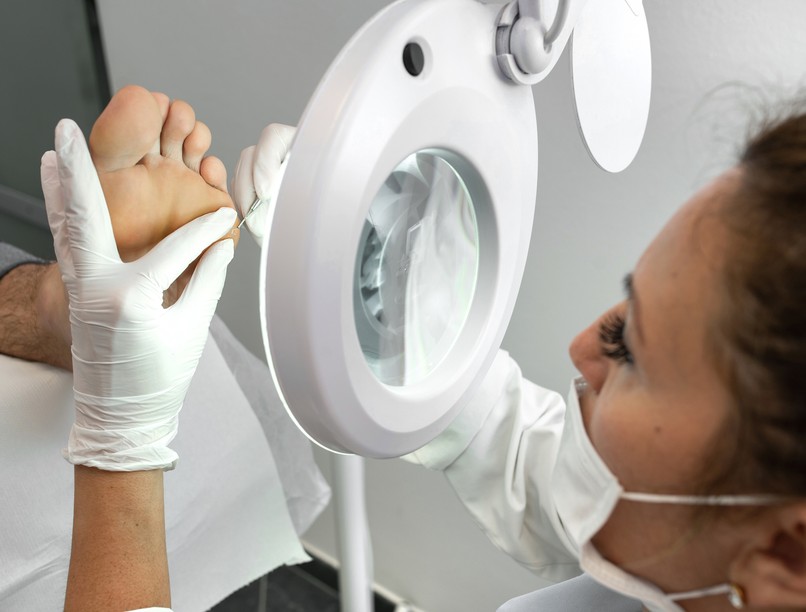 bőrkeményedés, ekcéma, allergia, hiperkeratosis