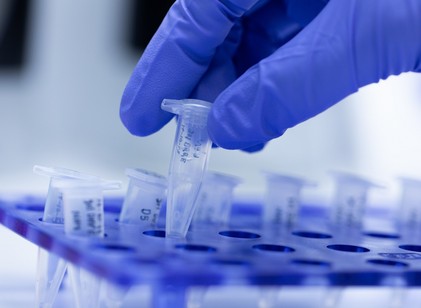 Új terápiát fejlesztenek magyar kutatók a COVID és az influenza ellen című cikk nyitóképe