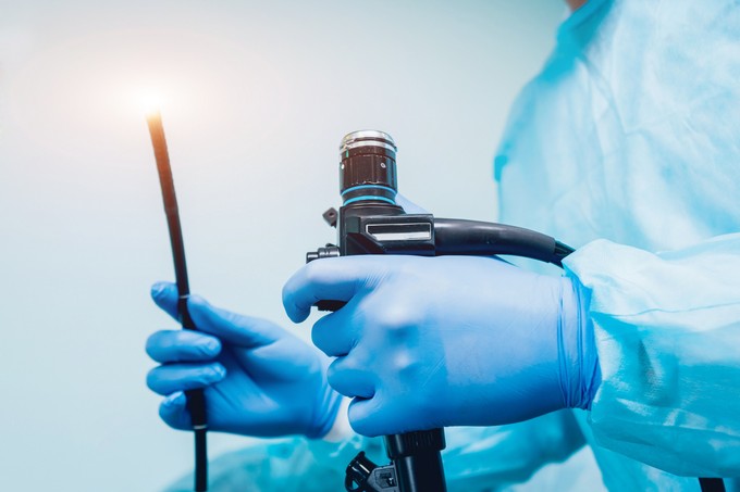 Vastagbéltükrözés: ezen múlik, hogy fájdalmas lesz-e című cikk nyitóképe