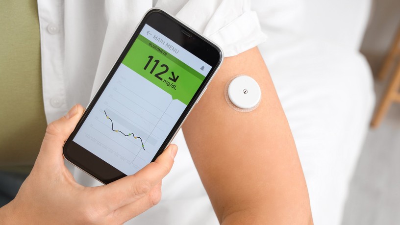 cukorbetegség cgm szöveti cukor monitorozás