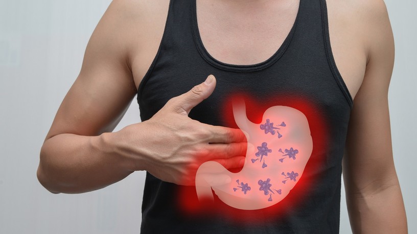 mi a gyomor adenocarcinoma jelentése gyomorrák
