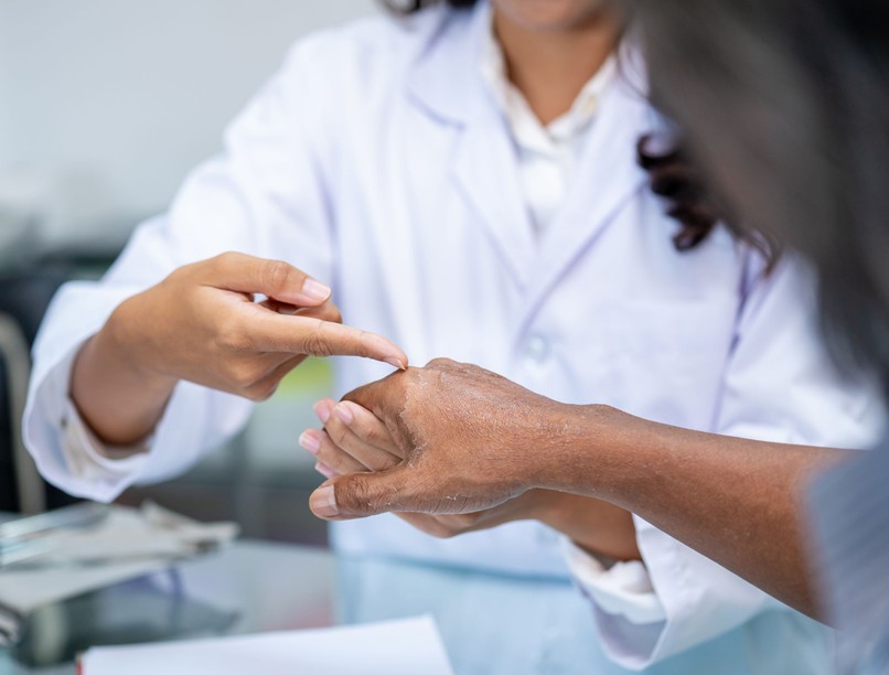 autoimmun betegség tünete, artritisz jele ízületek gyulladás