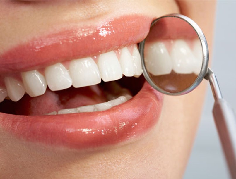 is-diy-teeth-whitening-good-for-you-banner_0