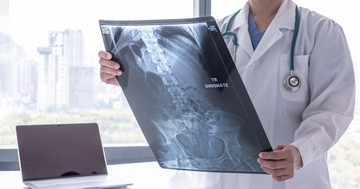 Mi a hasi röntgen és mit mutat ki?