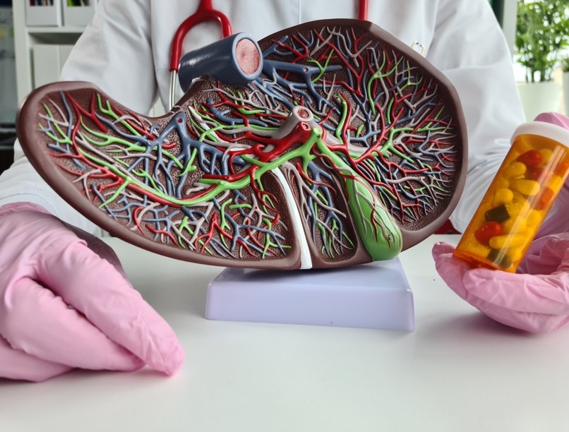 májbetegség, májkárosodás, étrend, táplálkozás