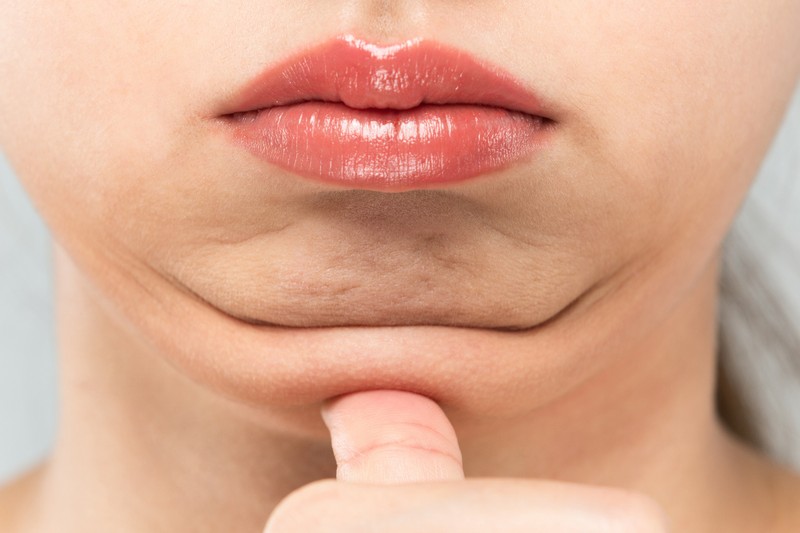 Mitől alakul ki a toka? Így lehet újra szép a nyakkontúrja