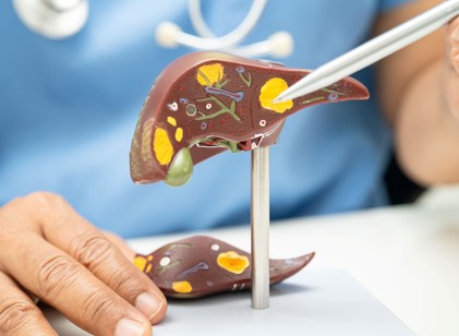 A tudósok figyelmeztetnek: ez a két tényező együtt súlyosan károsíthatja a májat című cikk nyitóképe