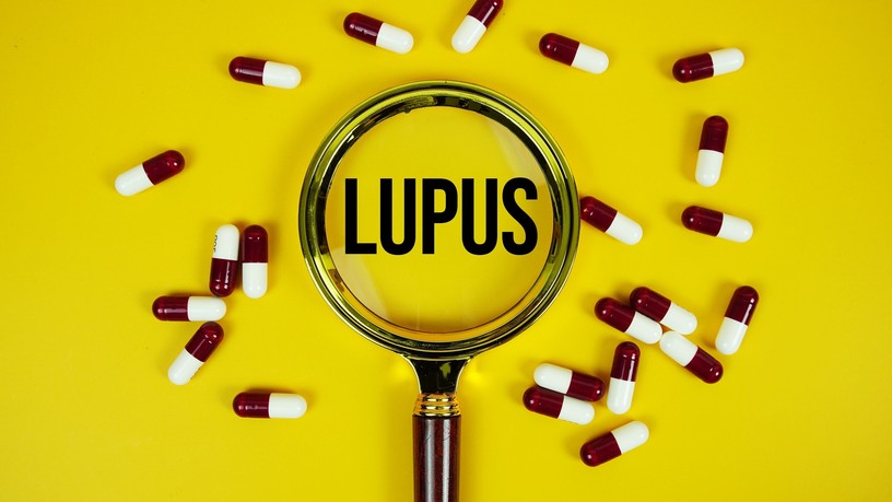 lupus szisztémás lupusz erythematosus SLE