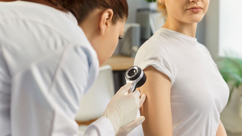 nem melanomás bőrrák mellett másik rák kialakulása