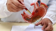Sokan naponta isznak ilyet, pedig veszélyes: több mint kétszeresére növelheti a gyomorrák kockázatát! című cikk nyitóképe