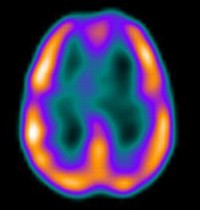 Rejtélyes fájdalmak - forduljunk az orvoshoz (2. rész)