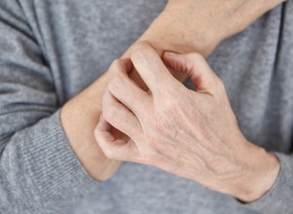 Ilyen nyomokat hagy a bőrön a pajzsmirigyzavar című cikk nyitóképe