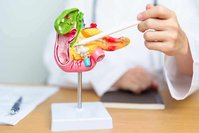 Ezért öl olyan gyorsan a hasnyálmirigyrák