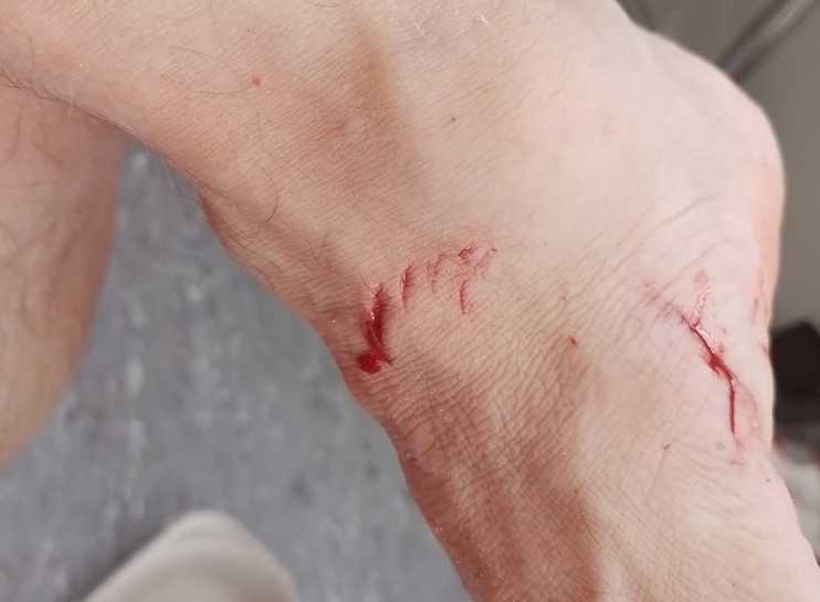 Cápa támadt egy úszóra: először csak egy kis ütést érzett a lábán, aztán ez történt