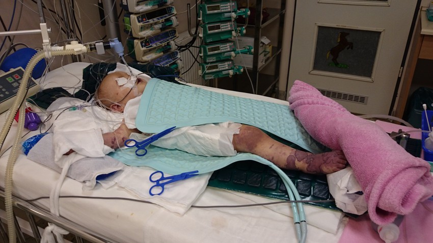 A kislány mozdulatlanul feküdt, már az egész jobb lába belilult