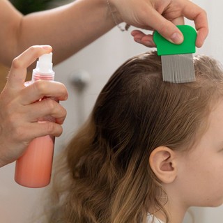 Fejtetű az óvodában? Ezt a 8 lépést tegye meg, hogy megállítsa a fertőzést! című cikk nyitóképe