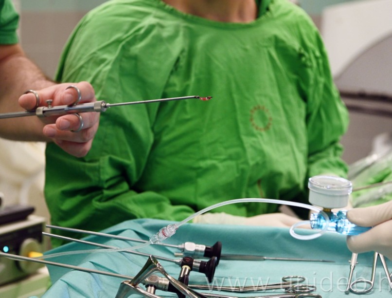 Debreceni Egyetem Fül-Orr-Gégészet sebészet légcsőszűkület műtét