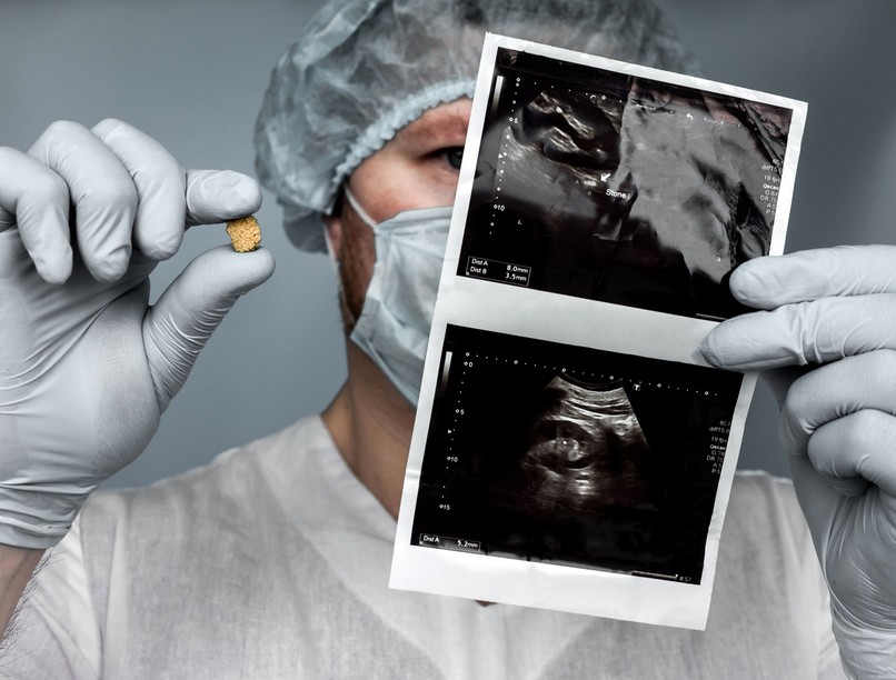 vesebetegségek vesekő Mitől alakul ki