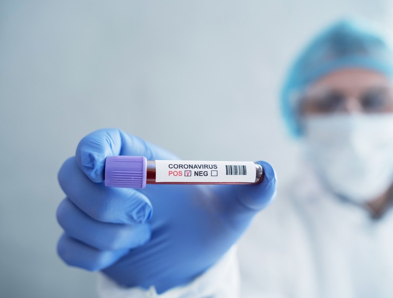 GettyImages-covid 19 teszt, koronavírus teszt