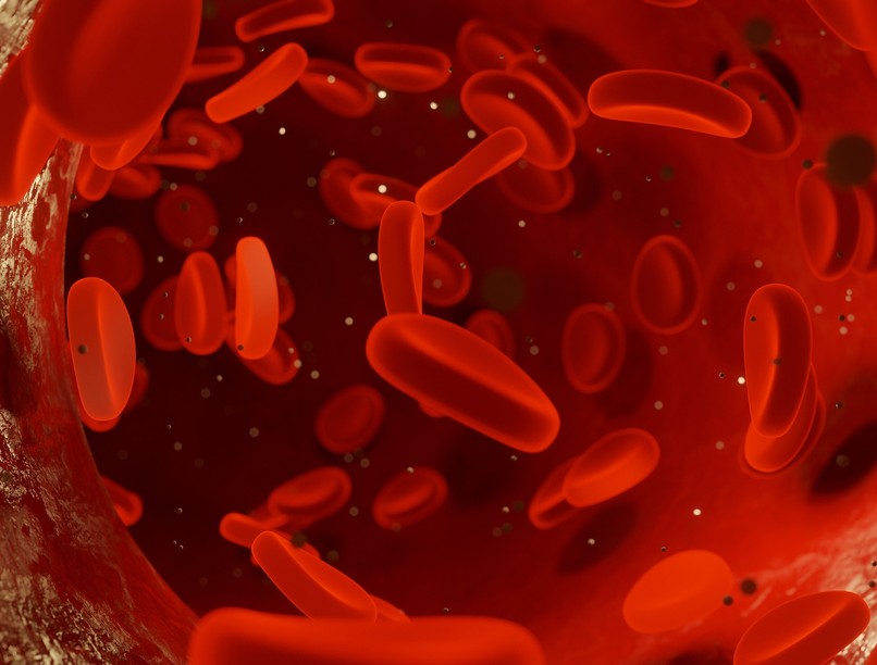 örökletes trombózis vérrög tünetei