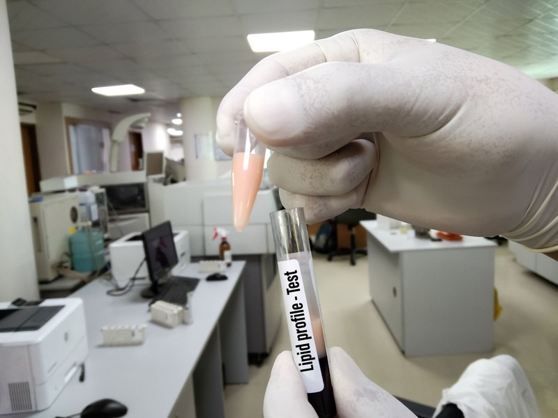 Felborult a lipidprofilja? Ezzel a 8 egyszerű lépéssel fellélegezhetnek az erei