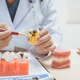 Többet számít, mint a fogmosás? Ezek az ételek kiirtják a rossz baktériumokat a szájból című cikk nyitóképe