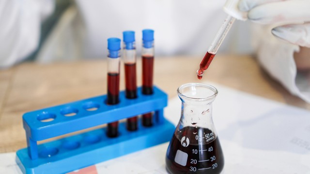 Ezzel a vérvizsgálattal több mint félszáz ráktípus kimutatható