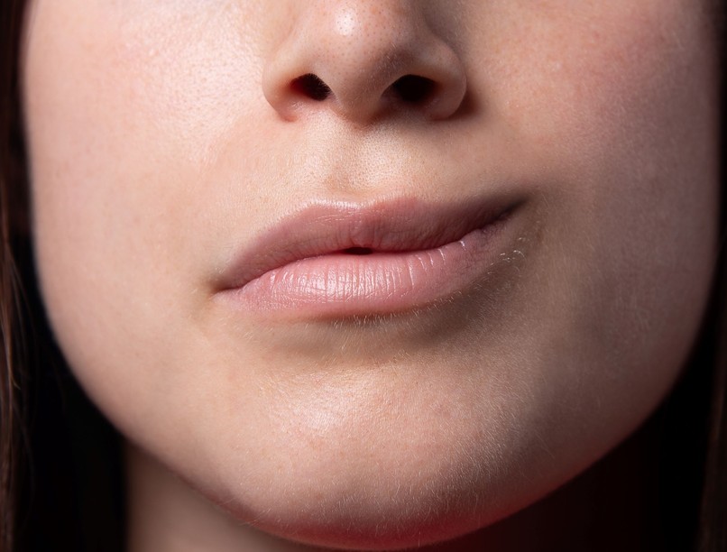 Bell-féle arcidegbénulás oka fájdalom övsömör