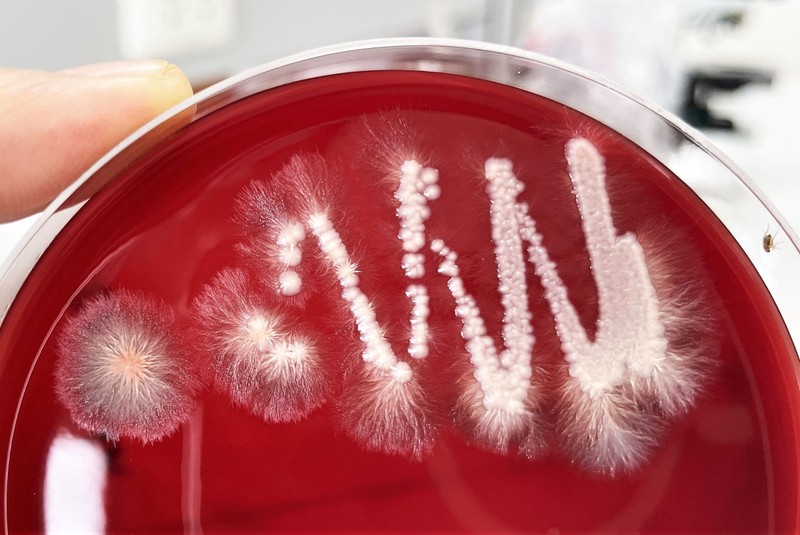 Candida-fertőzésre gyanakszik? Ezzel a módszerrel derítheti ki biztosan!