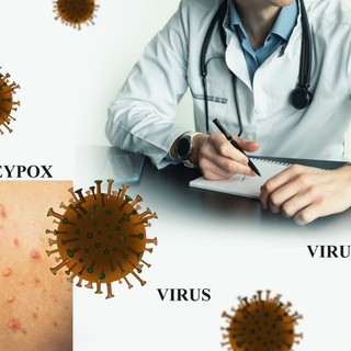 Majomhimlő: tünetei, vizsgálata és kezelési lehetőségei című cikk nyitóképe