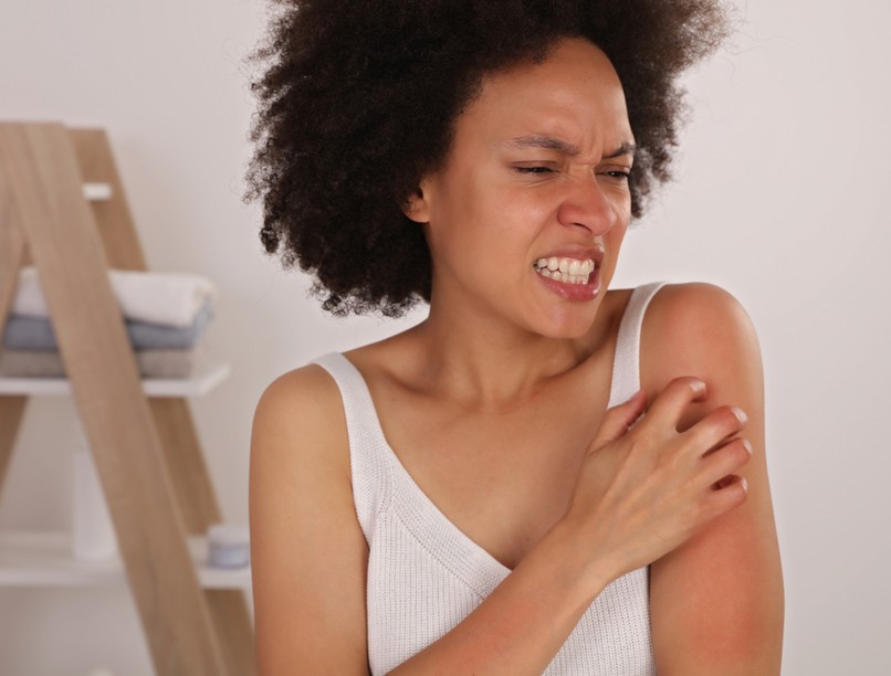 ekcéma, viszketés, ekcémás tünetek, bőrbetegség