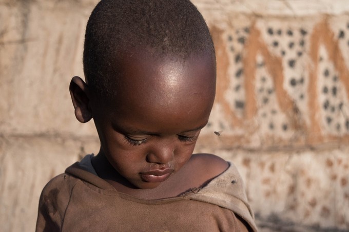Álomkór: ezek a tünetei című cikk nyitóképe
