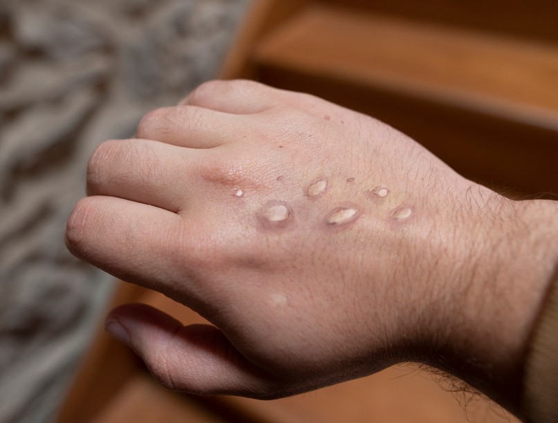 majomhimlő, férfi, nnk, magyarország