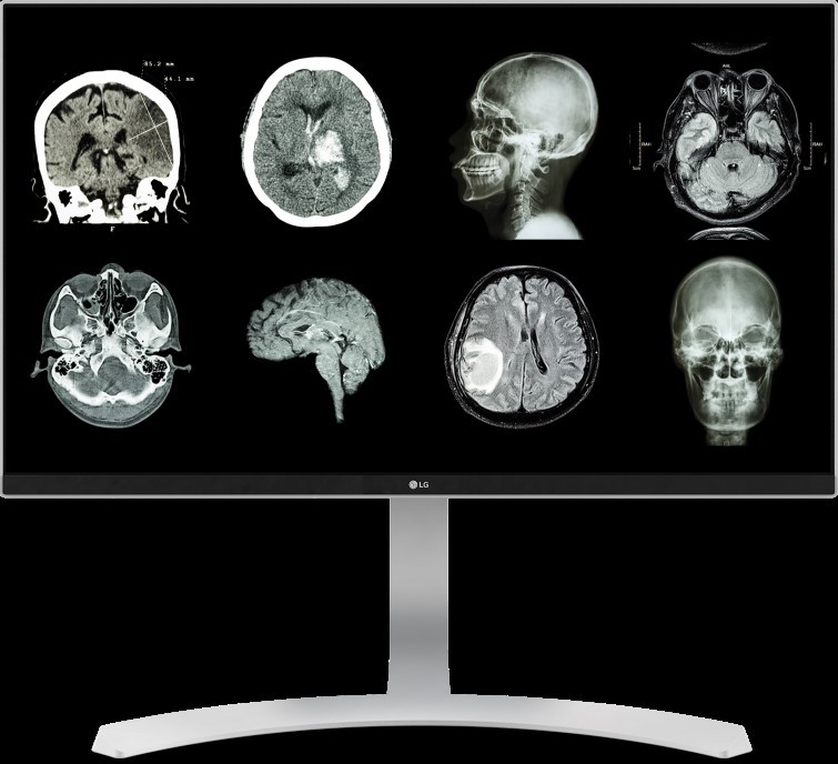 Magyarországra is megérkeztek az LG egészségügyi monitorai